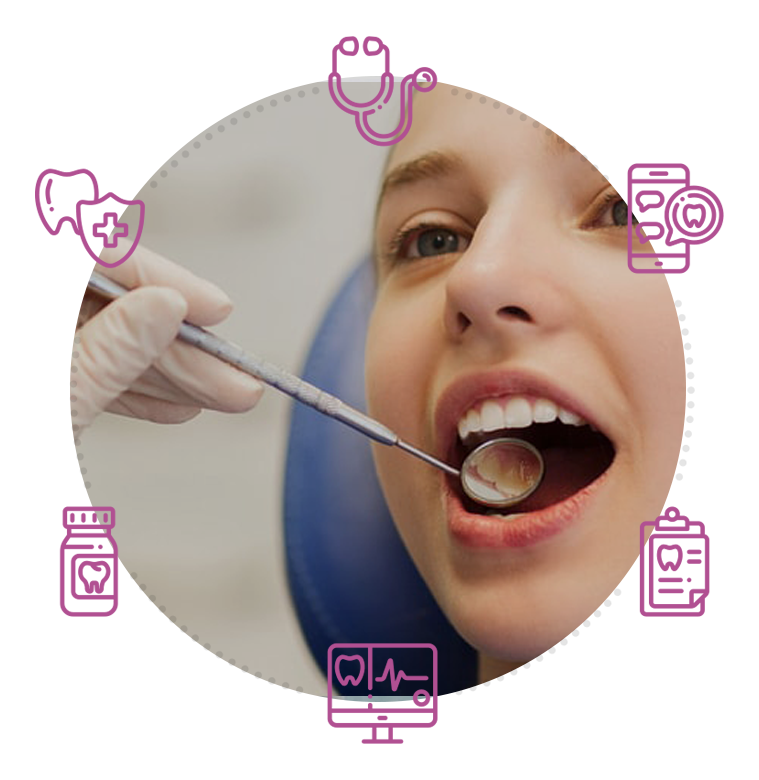 Composite Fillings