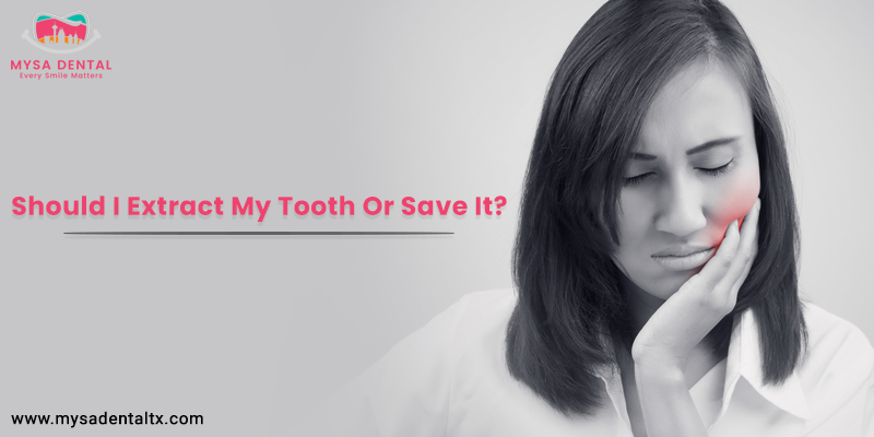 Tooth Extraction San Antonio