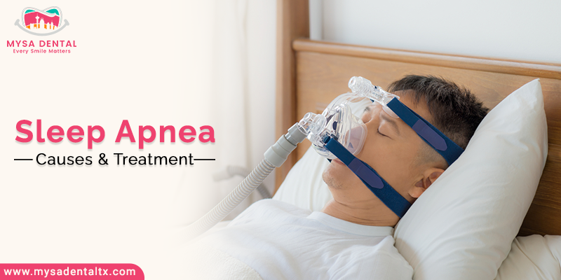 Sleep Apnea: Causes and Treatment