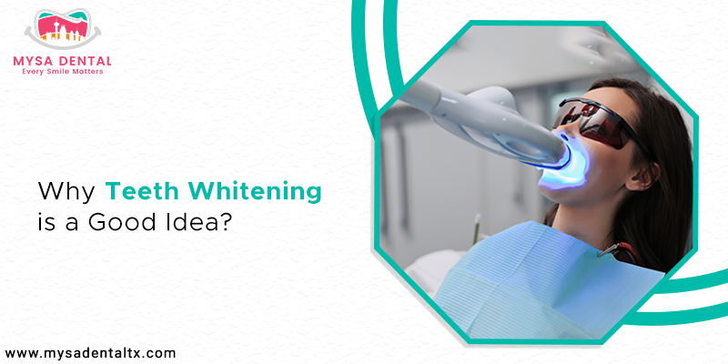 Why Teeth Whitening is a Good Idea?