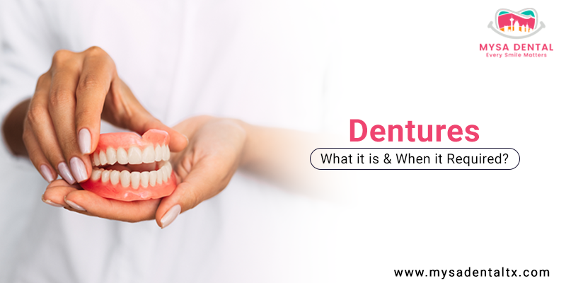 What Are Dentures and When do Patients Require Them?