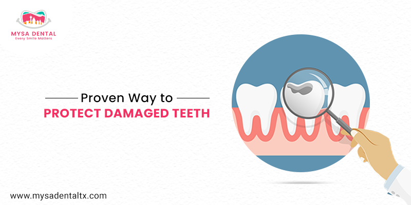 Way to Protect Damaged Teeth